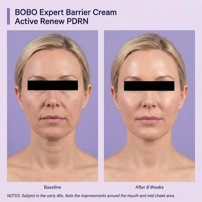 Firming Expert Madeca Cream — Advanced PDRN Formula